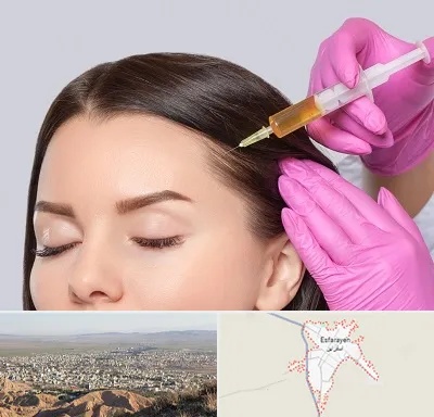 تزریق هیر فیلر در اسفراین