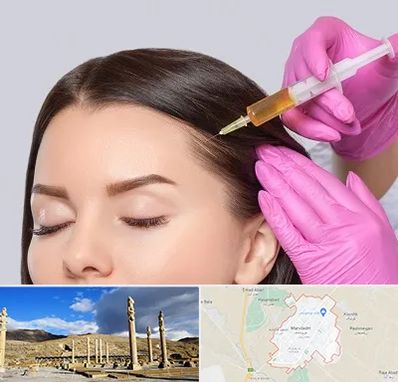 تزریق هیر فیلر در مرودشت