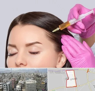 تزریق هیر فیلر در شمس آباد تهران