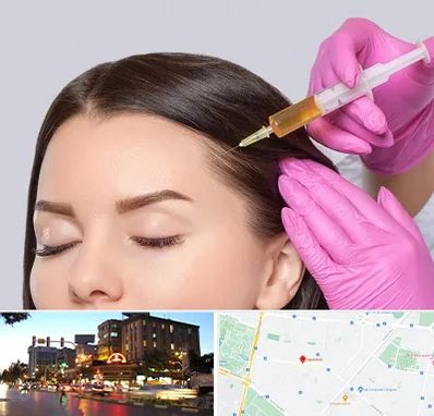 تزریق هیر فیلر در بلوار سجاد مشهد 