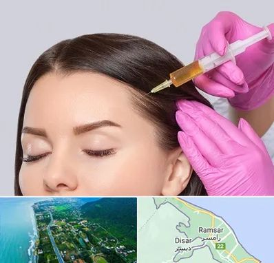 تزریق هیر فیلر در رامسر