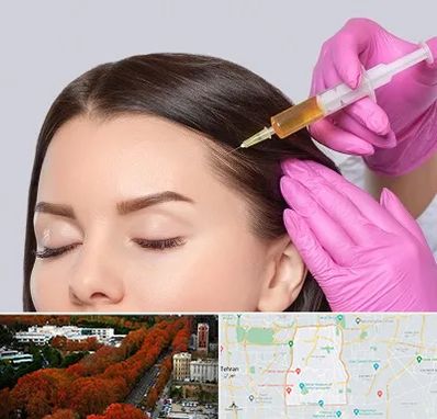 تزریق هیر فیلر در منطقه 6 تهران 