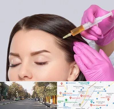 تزریق هیر فیلر در شریعتی 