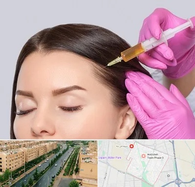 تزریق هیر فیلر در فاز سه اندیشه