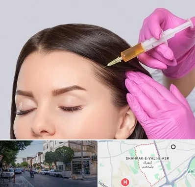 تزریق هیر فیلر در شهرک ولیعصر