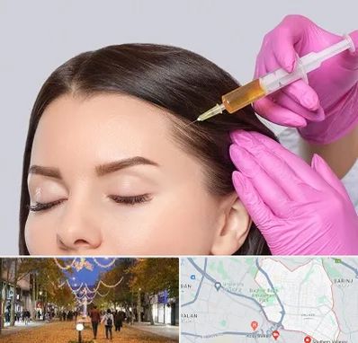 تزریق هیر فیلر در ولیعصر ارومیه