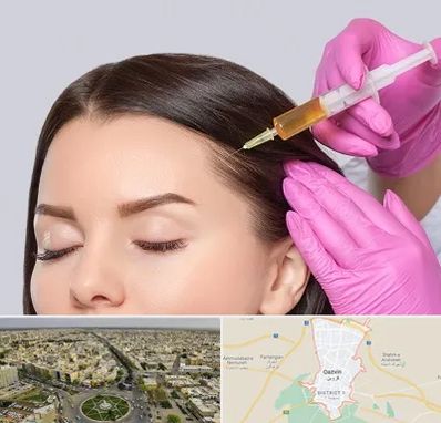 تزریق هیر فیلر در قزوین