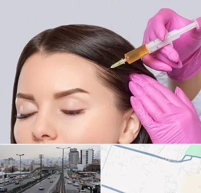 تزریق هیر فیلر در بلوار ارتش