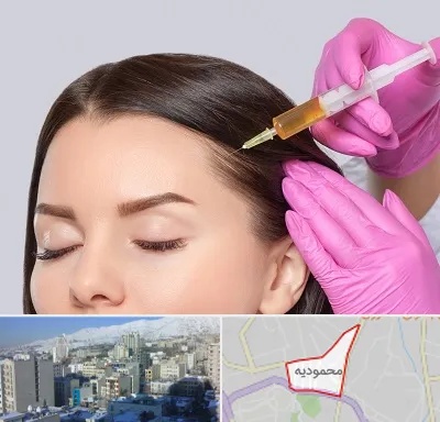 تزریق هیر فیلر در محمودیه