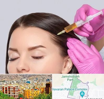 تزریق هیر فیلر در نیاوران 