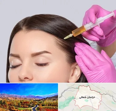تزریق هیر فیلر در خراسان شمالی