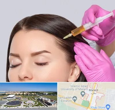 تزریق هیر فیلر در ملارد