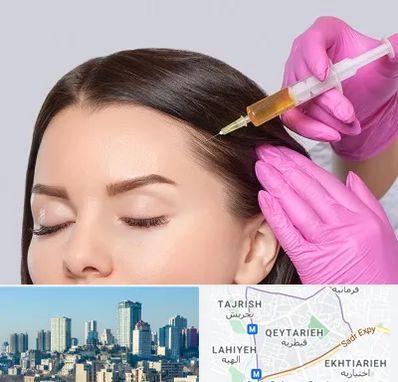 تزریق هیر فیلر در قیطریه 