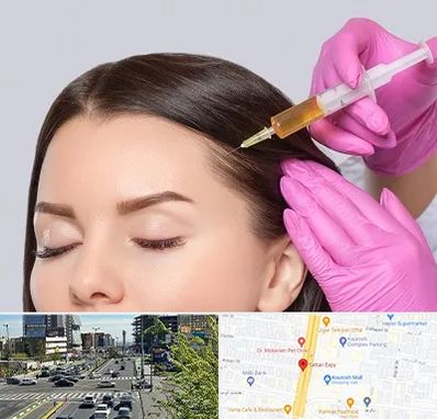 تزریق هیر فیلر در ستاری 