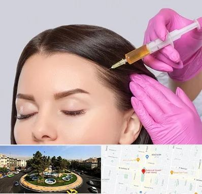 تزریق هیر فیلر در هفت حوض 