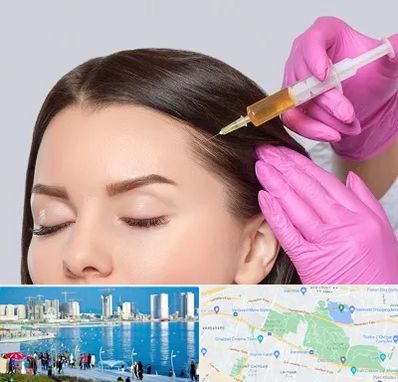 تزریق هیر فیلر در چیتگر 