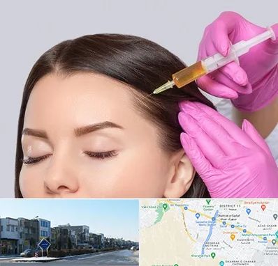 تزریق هیر فیلر در شریعتی مشهد