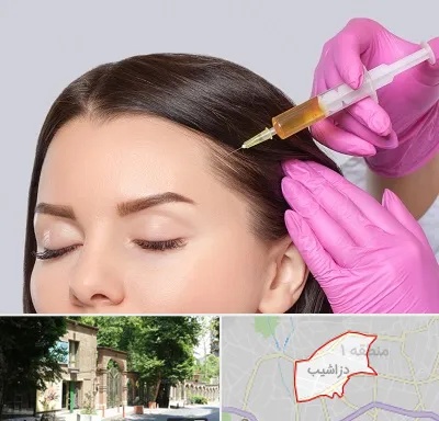 تزریق هیر فیلر در دزاشیب