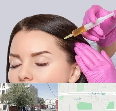 تزریق هیر فیلر در طرشت