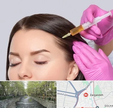 تزریق هیر فیلر در زرگنده