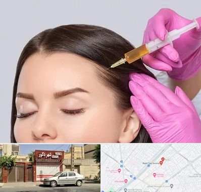 تزریق هیر فیلر در باجک قم