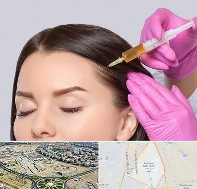 تزریق هیر فیلر در اندیشه