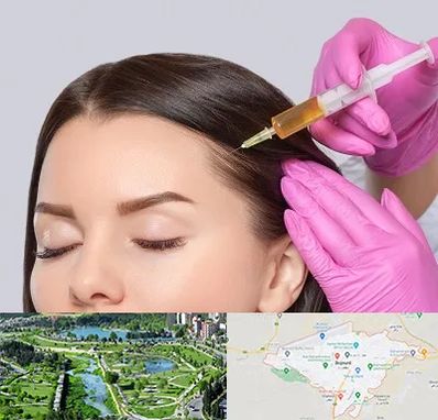 تزریق هیر فیلر در بجنورد