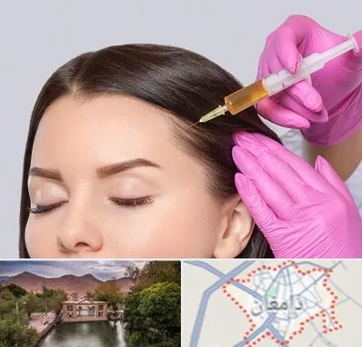 تزریق هیر فیلر در دامغان