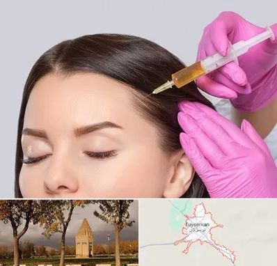 تزریق هیر فیلر در تویسرکان