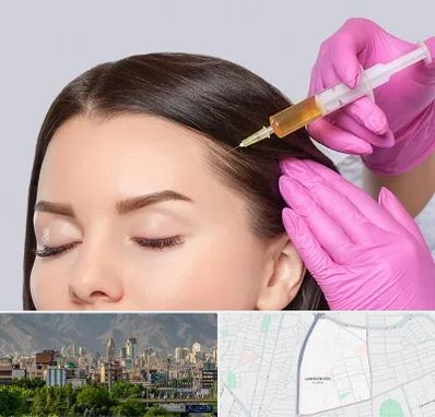 تزریق هیر فیلر در جمشیدیه