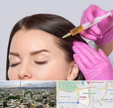 تزریق هیر فیلر در گیشا 