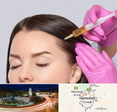 تزریق هیر فیلر در همدان