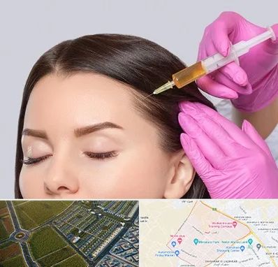 تزریق هیر فیلر در الهیه مشهد