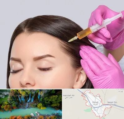 تزریق هیر فیلر در دورود