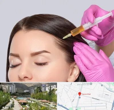 تزریق هیر فیلر در بلوار تعاون