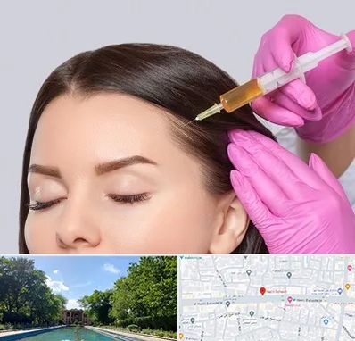 تزریق هیر فیلر در هشت بهشت اصفهان