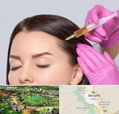 تزریق هیر فیلر در بروجرد