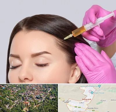 تزریق هیر فیلر در دماوند