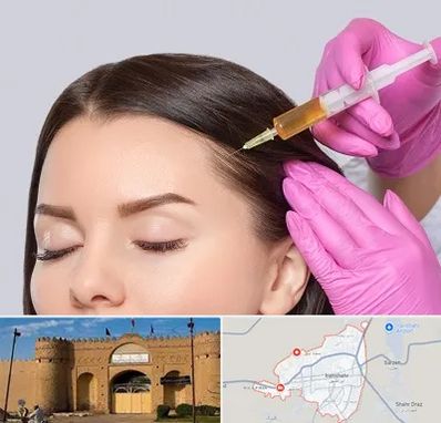 تزریق هیر فیلر در ایرانشهر