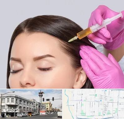 تزریق هیر فیلر در 17شهریور