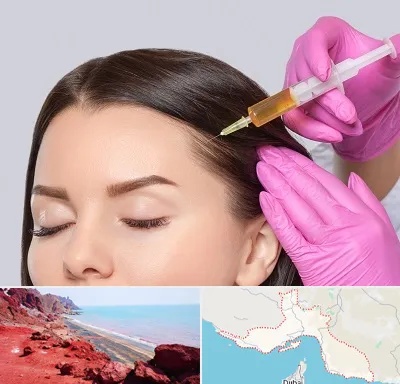 تزریق هیر فیلر در هرمزگان