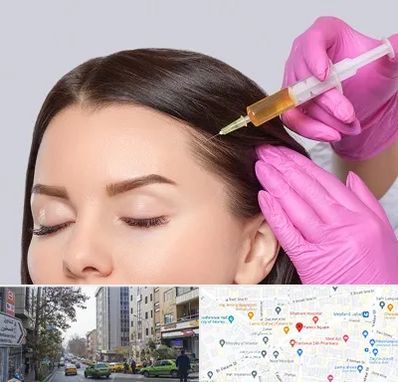 تزریق هیر فیلر در فاطمی 