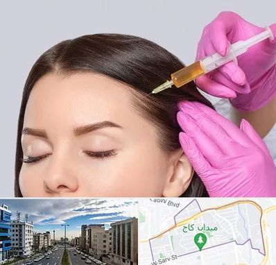 تزریق هیر فیلر در سعادت آباد 