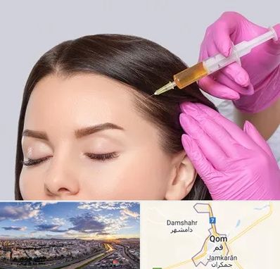 تزریق هیر فیلر در قم