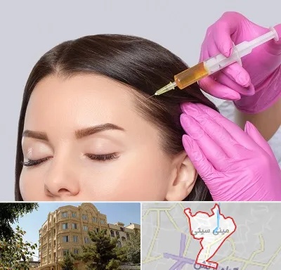 تزریق هیر فیلر در مینی سیتی