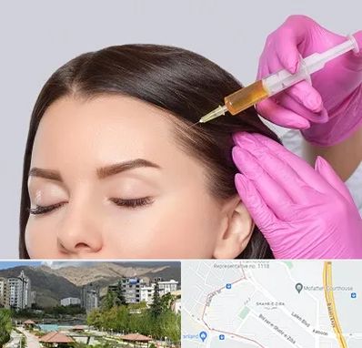 تزریق هیر فیلر در شهر زیبا 