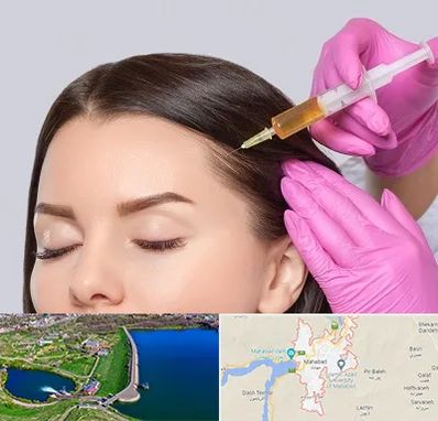 تزریق هیر فیلر در مهاباد