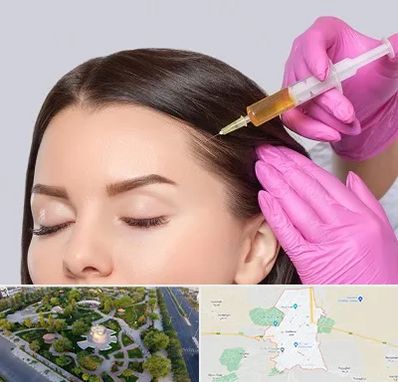 تزریق هیر فیلر در کاشمر