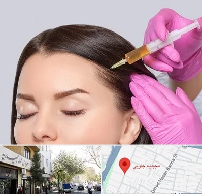 تزریق هیر فیلر در مجیدیه جنوبی
