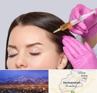 تزریق هیر فیلر در کرمانشاه